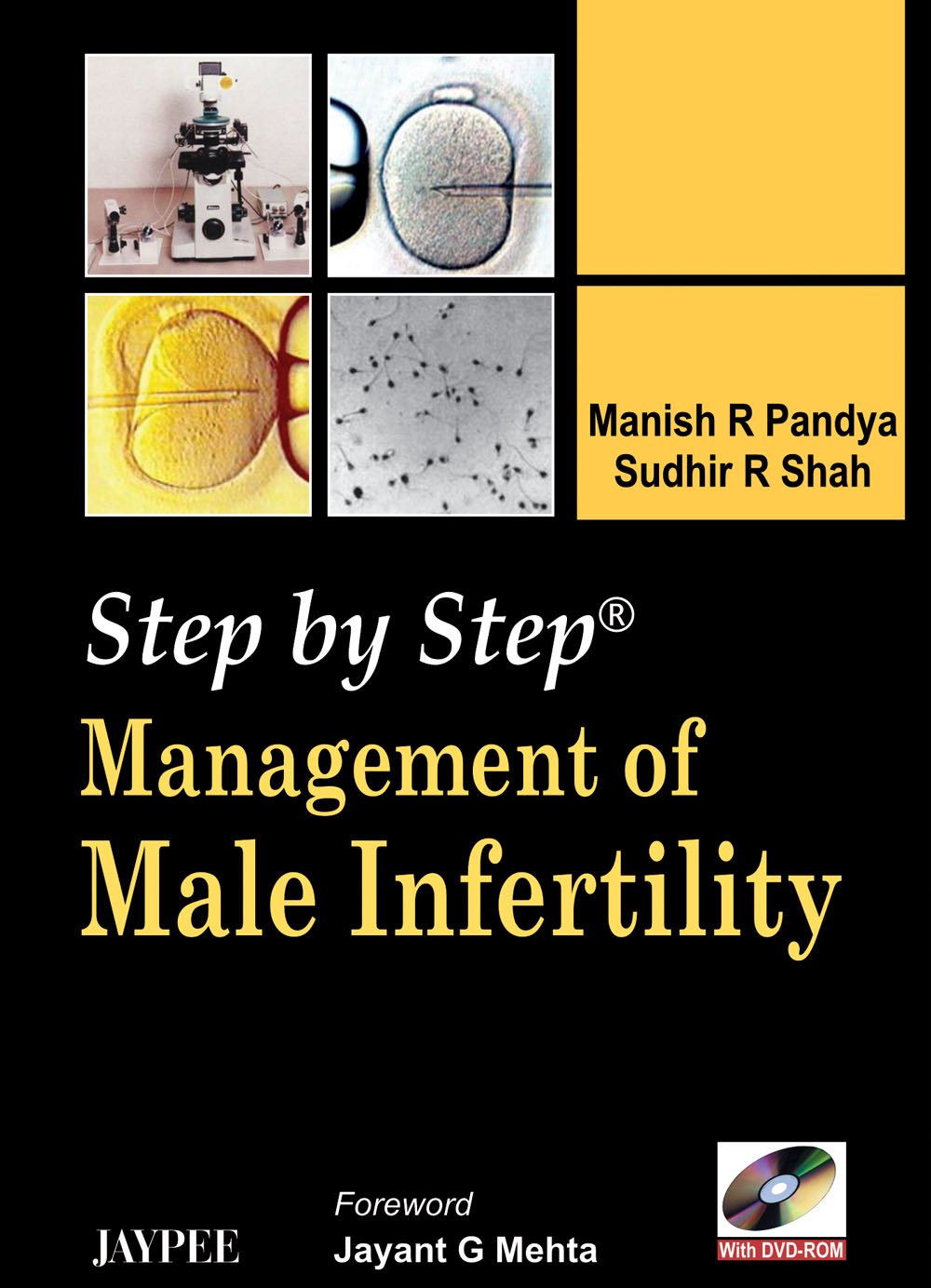 Step by Step: Management of Male Infertility