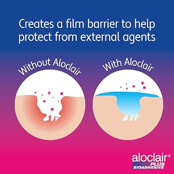 Aloclair Plus Bioadhesive Gel 8ml | Mouth ulcers and small oral lesions, Up to 12+ hours protection, No-touch application, Adults and children 4 years+