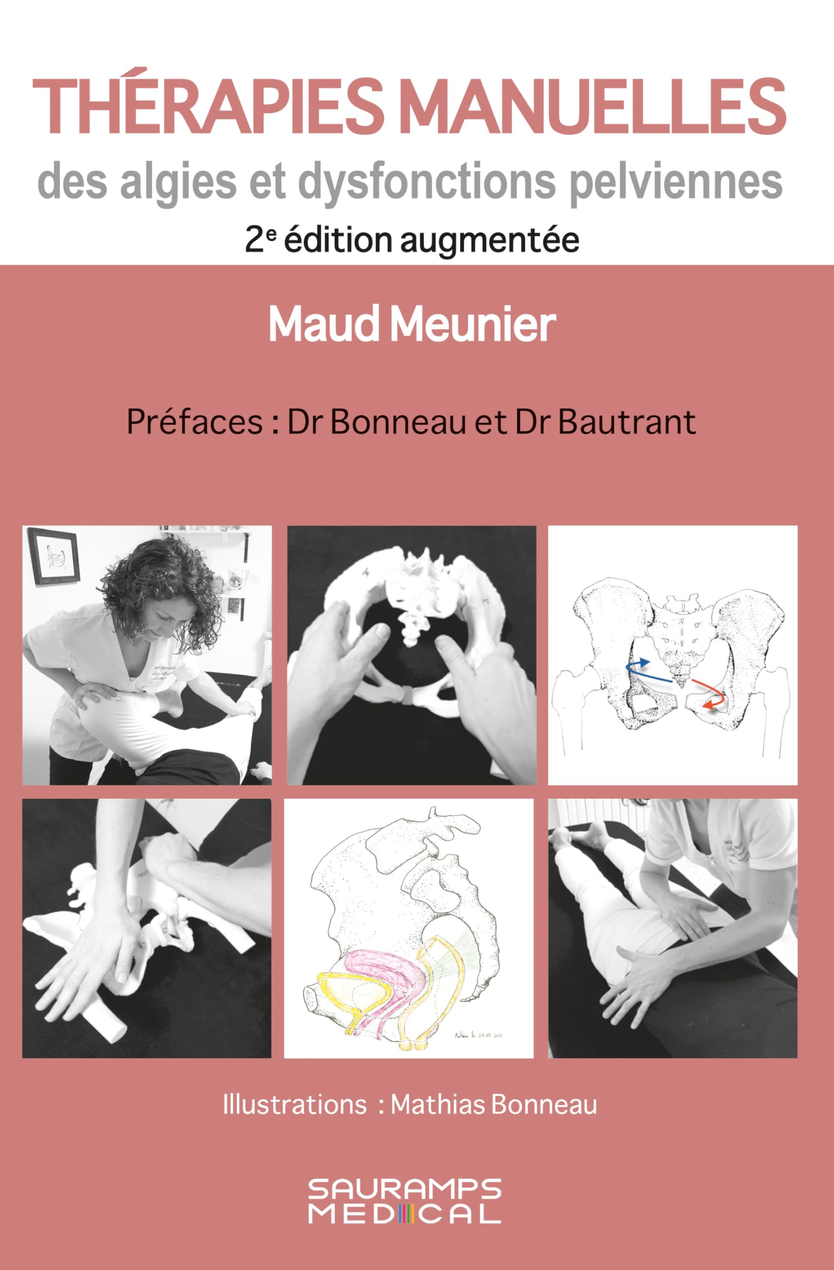 Thérapies manuelles des algies et dysfonctions pelviennes 2ed