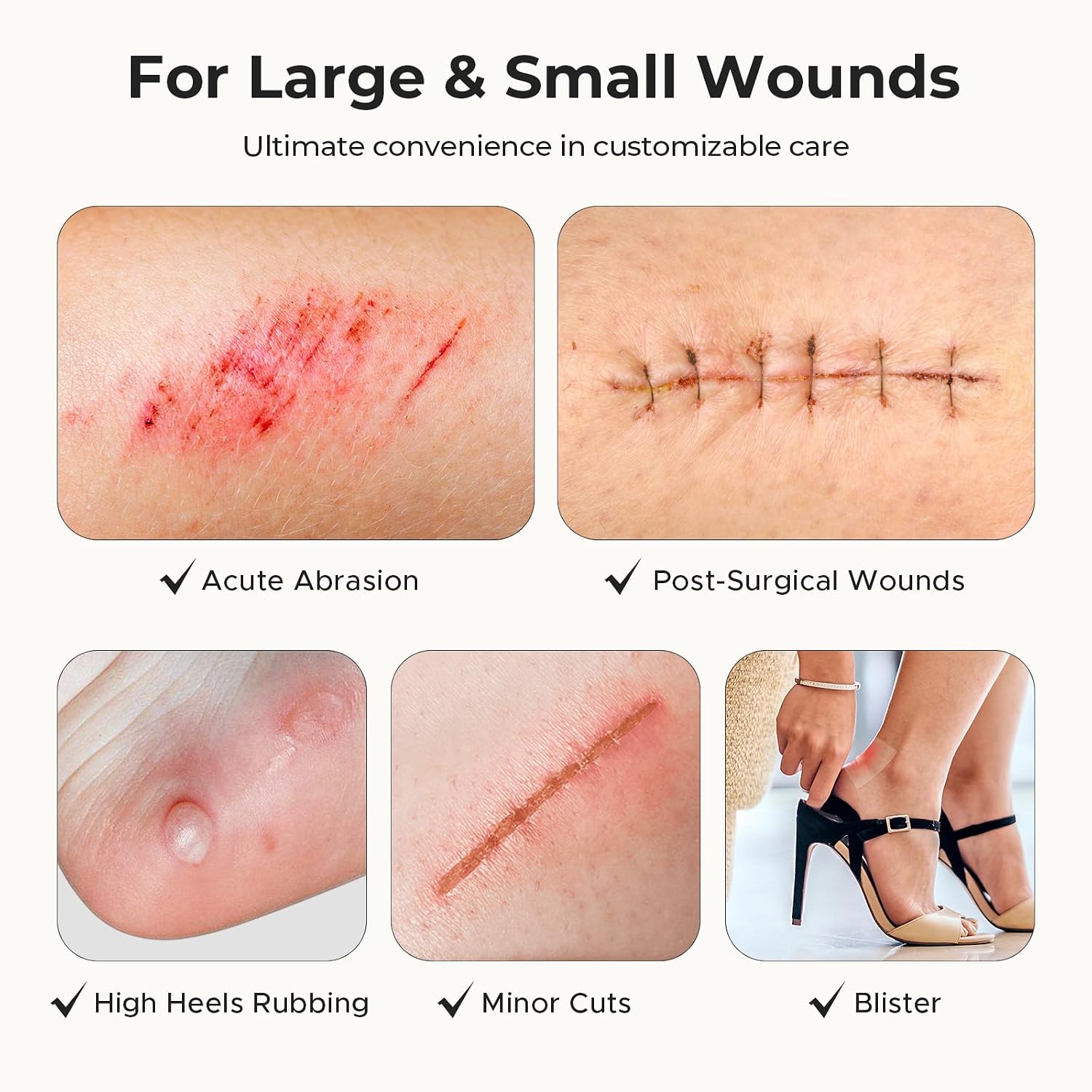 TKTK Hydrocolloid Roll 2 Sizes, Cut-to-Fit Bandages for Pimple & Wounds