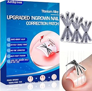 Ingrown Toenail Treatment with Upgraded 6-Angle Shape,Titanium Alloy Ingrown Toenail Corrector for Quick Relief,At-Home Ingrown Toenail Removal Kit for Toenail Curled Corrector,9Pcs