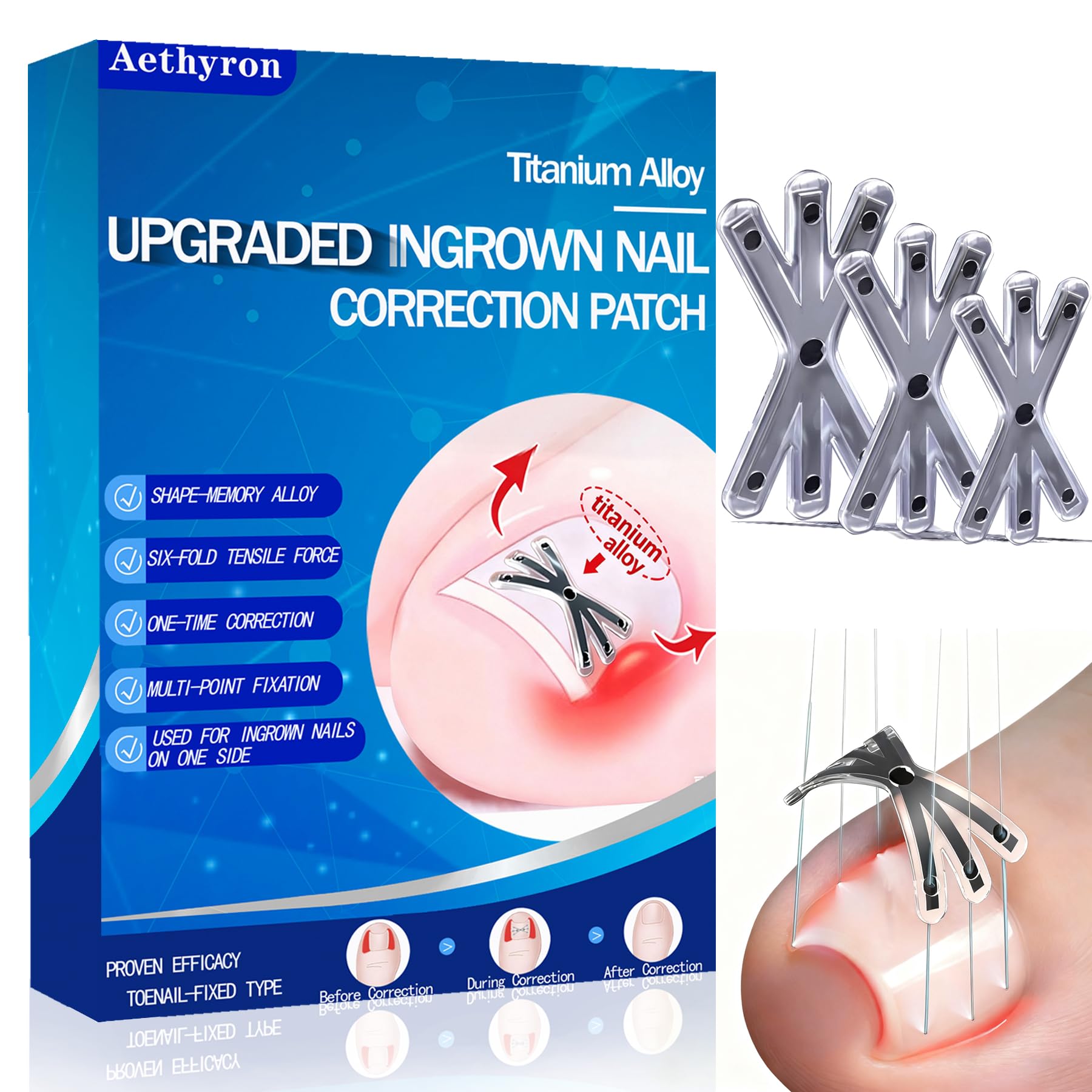 Ingrown Toenail Treatment with Upgraded 6-Angle Shape,Titanium Alloy Ingrown Toenail Corrector for Quick Relief,At-Home Ingrown Toenail Removal Kit