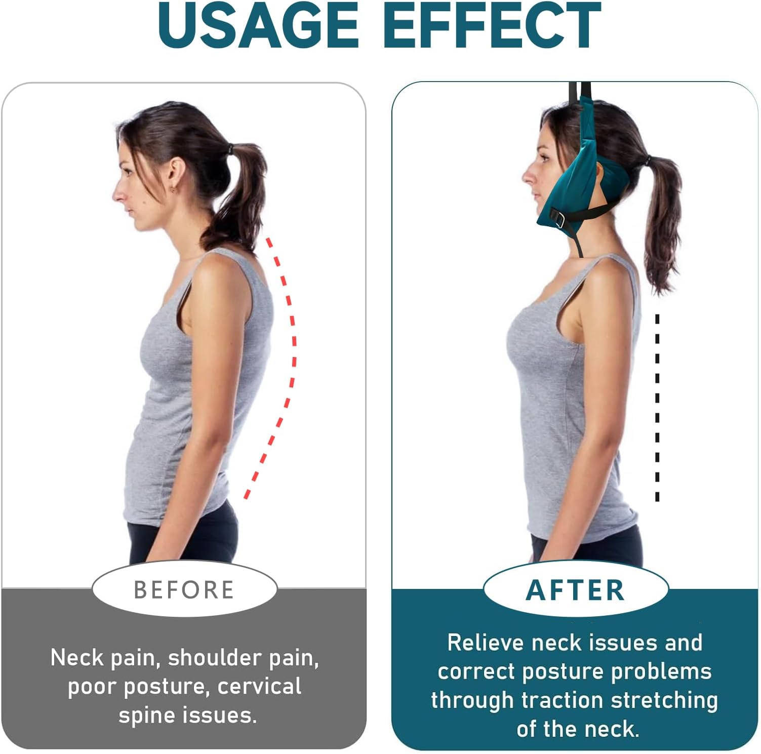Upgraded Neck Stretcher Cervical Traction Device 233