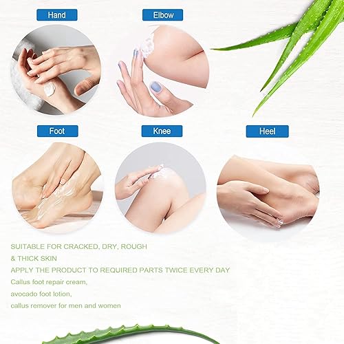 Miniatura 2 de Crema de urea 40 para reparación de pies agrietados en el talón crema de manos mejorada removedor de callos crema para pies para talones secos