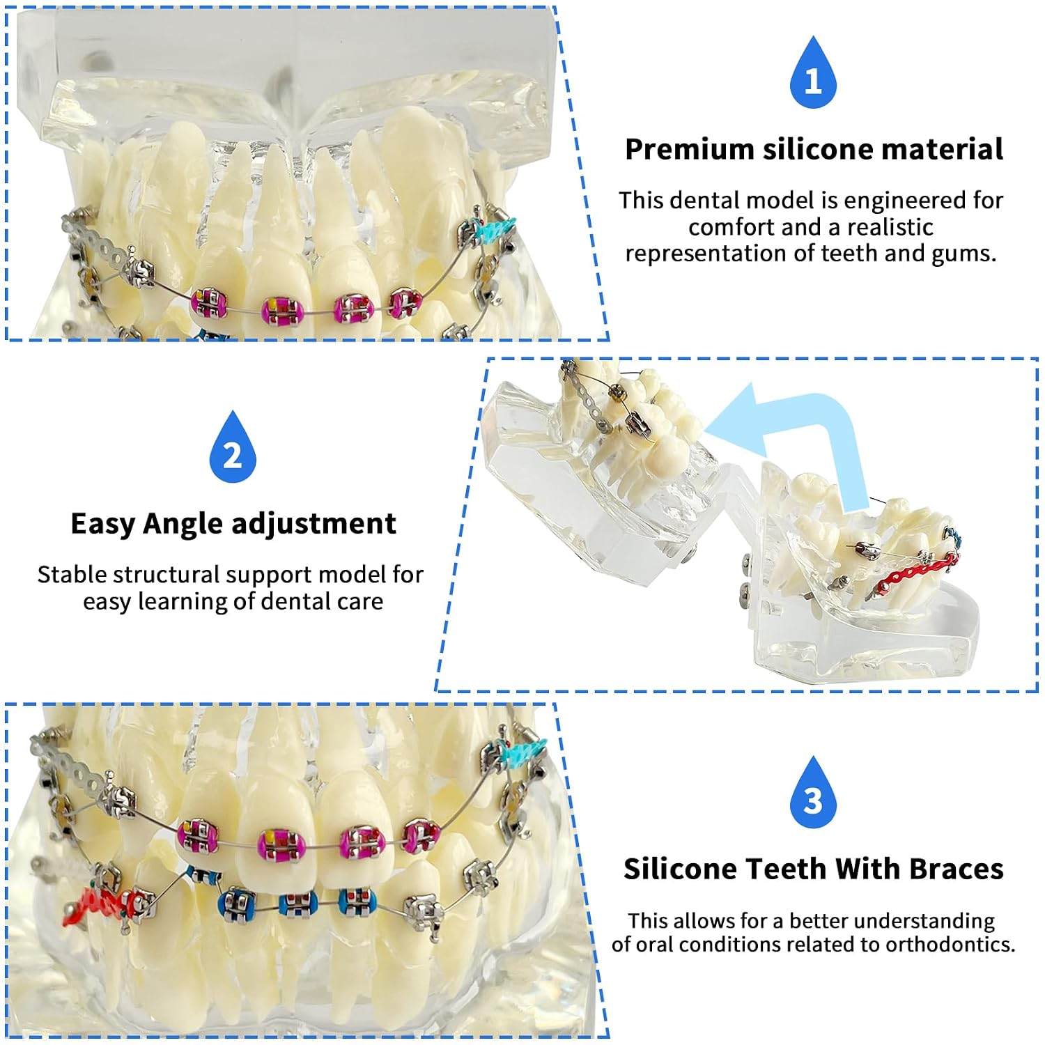Orthodontic Demonstration Model with Stainless Steel Brackets and Colorful Ligatures - Misaligned Teeth Correction Display on Transparent Acrylic Base - Ideal for Educational and Training Purposes