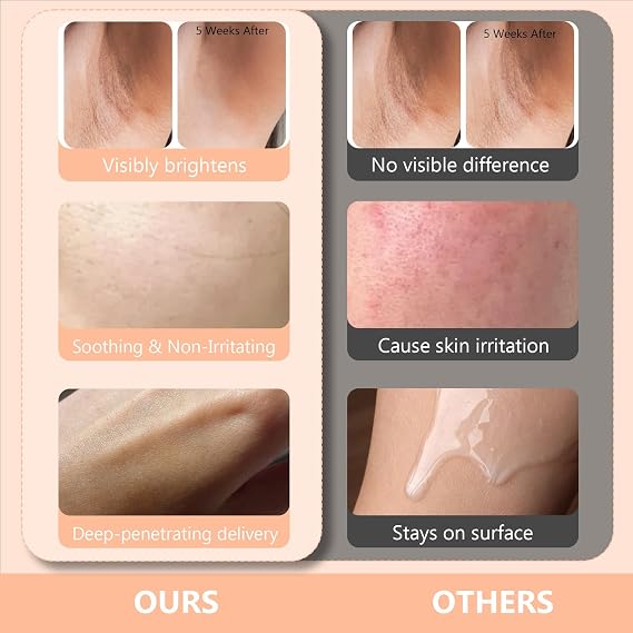 Skin Bleaching Cream for Body-Dark Spots Remover Lightening Cream & Uneven Tone Nourishing Formula Bleaching Intimate Areas & Underarms Inner Thigh, Bikini Line, Armpit Knees Elbows for All Skin Types