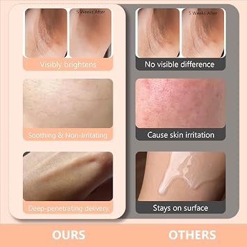 Skin Bleaching Cream for Body-Dark Spots Remover Lightening Cream & Uneven Tone Nourishing Formula Bleaching Intimate Areas & Underarms Inner Thigh, Bikini Line, Armpit Knees Elbows for All Skin Types