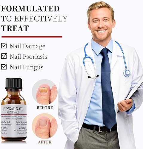 Miniatura 2 de Zemmys Tratamiento de hongos de uñas extra fuerte para uñas de los pies o uñas, líquido de reparación de uñas de acción rápida para uñas dañadas y