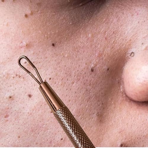Miniatura 7 de 2 Herramienta profesional de acero inoxidable para eliminar puntos negros, herramienta extractor de manchas  acné, piel, nariz, cara, zona de
