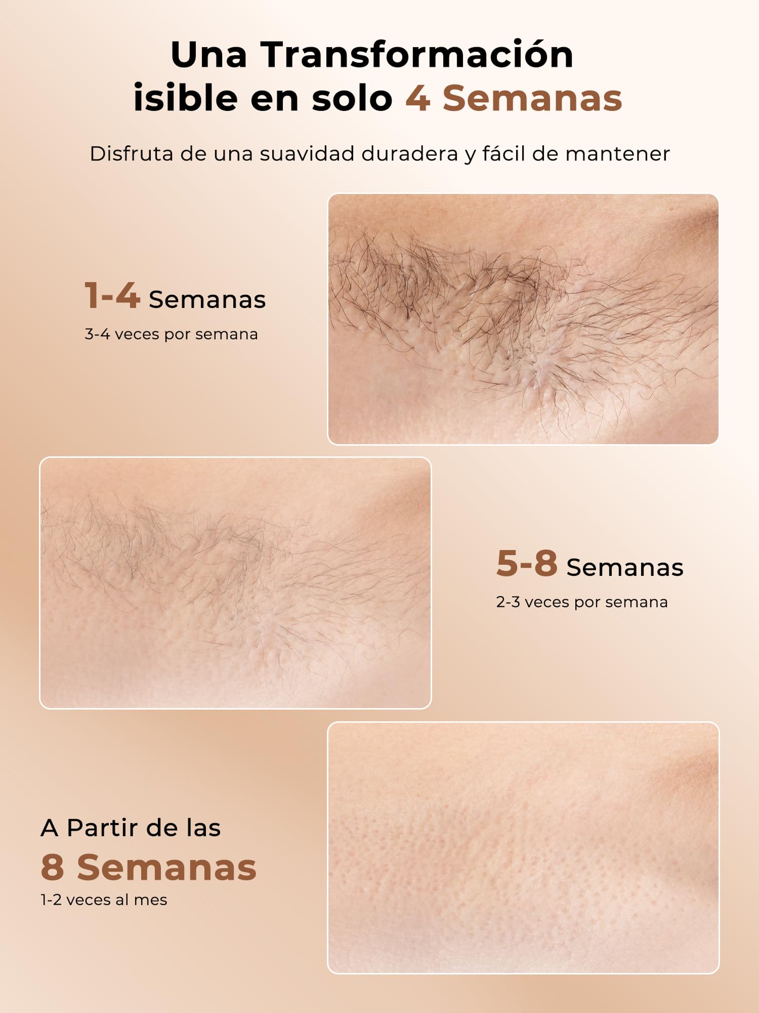 Depiladora Láser IPL con Enfriamiento para Mujer, Blanco Perlado