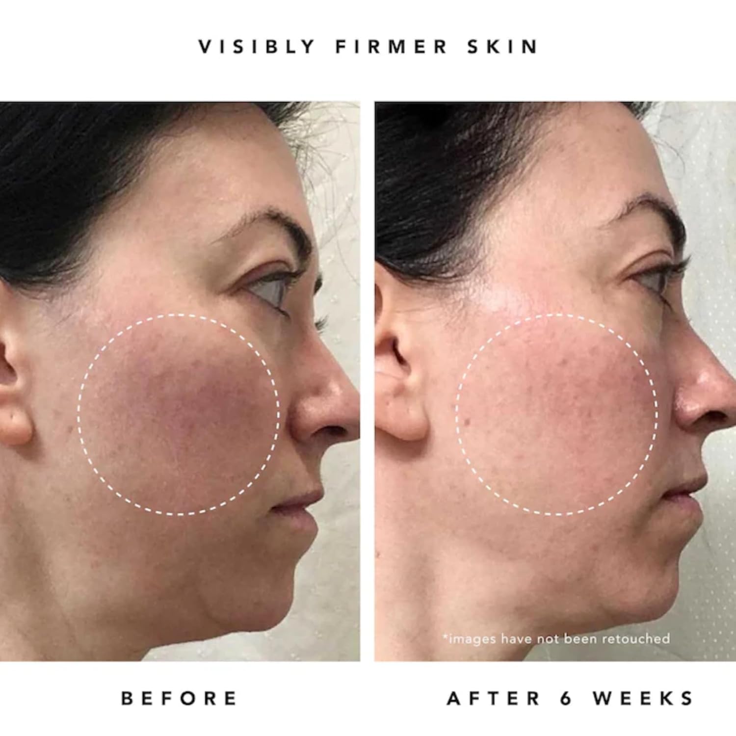 HERBIVORE Wrinkle-Fighting Regimen – MOON FRUIT 1% Bakuchiol & Peptides Serum + PHOENIX Rosehip Anti-Aging Face Oil - for Smoother, Youthful Skin, Plant-based, Vegan, Cruelty-free - Image 7