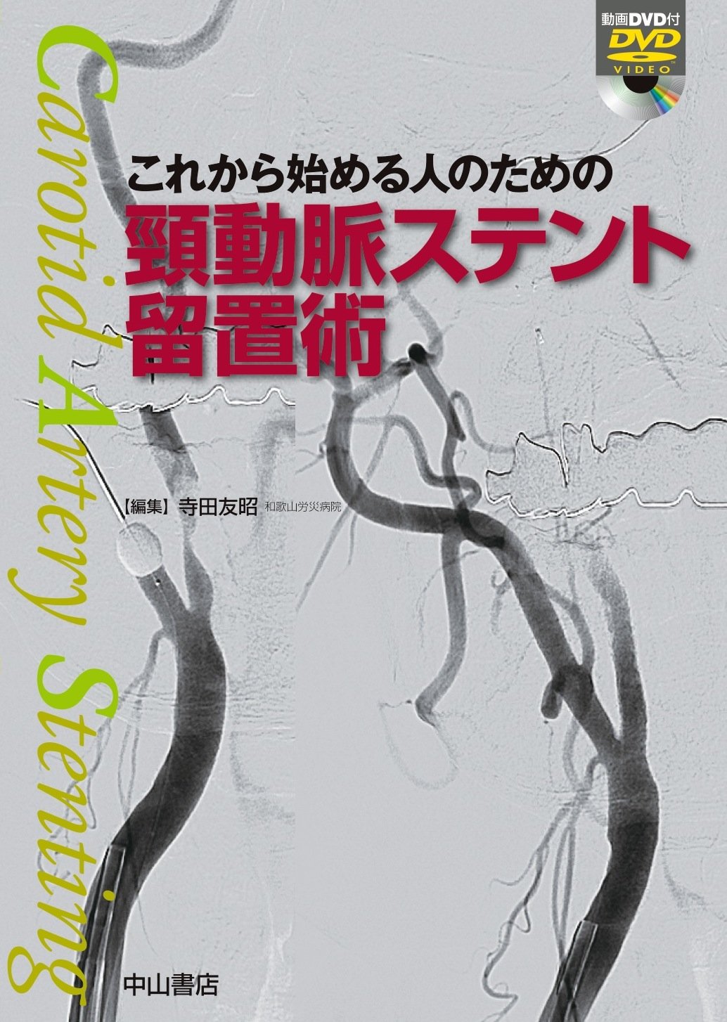 これから始める人のための頸動脈ステント留置術 | 寺田 友昭 |本