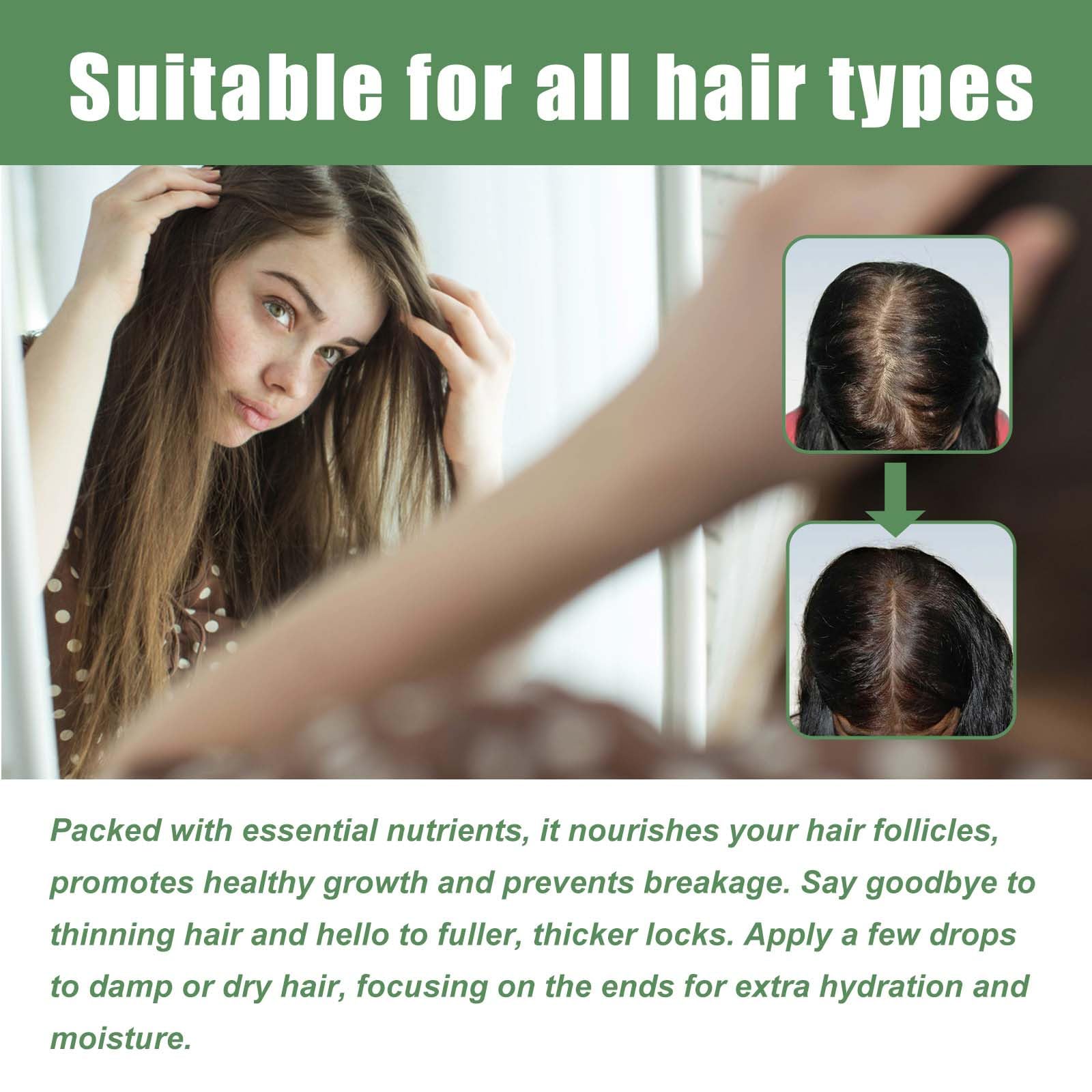 Sérum Capillaire Raw Batana - Stimule La Croissance Naturelle Des Cheveux - Huile 3.4 Fl Oz - Neuf - Marque CLFJLXYX - Unisexe
