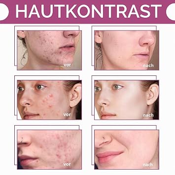 Aqua Peeling Solution AO3 Care Aqua facial lösungen Cleansing Serum Peeling-Lösung Hautpflege Dermabrasion Gesichtsreinigungsserum für Hautpflege Schönheitsmaschine