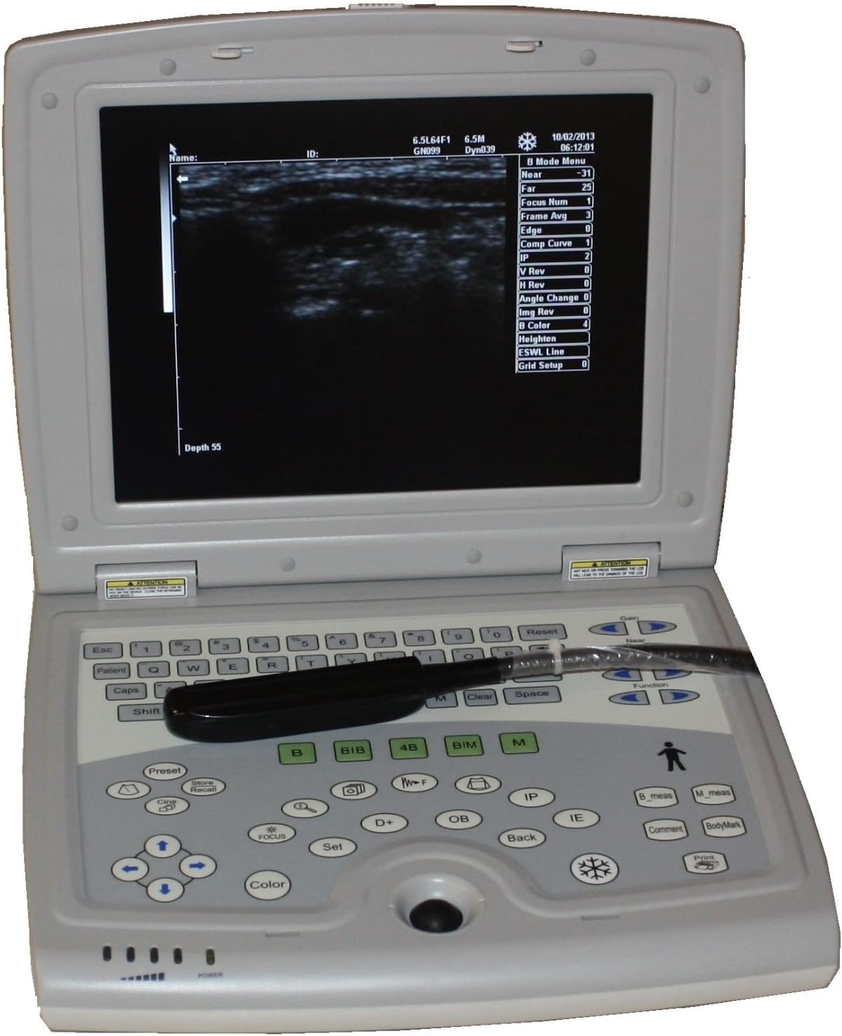 ECO12Vet Veterinary Hanheld Ultrasound-Large Animal-Bovine/Horse- Keebomed