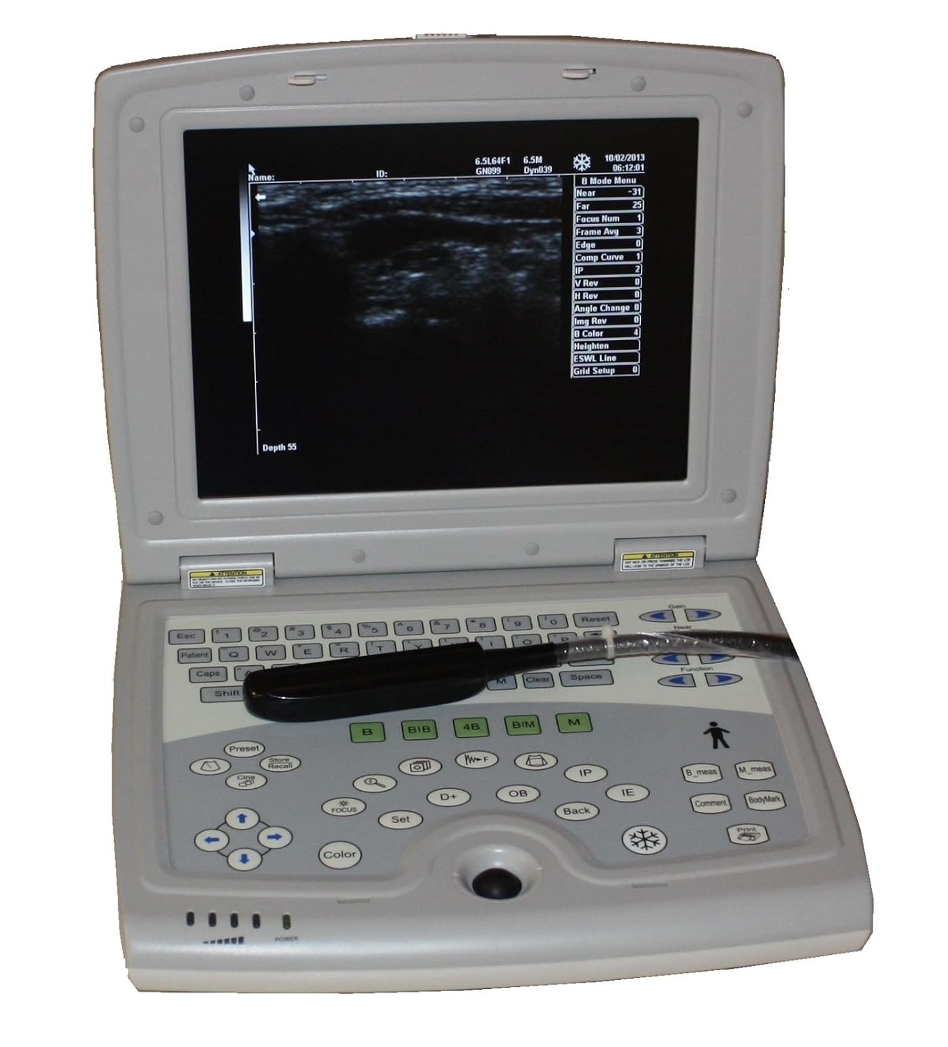 KX5000V Veterinary Laptop Ultrasound-Large Animal-Bovine/Horse- Keebomed : Patio, Lawn & Garden