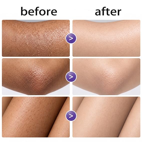Skin Moisturizer Body Lotion-Japanese Cream, Long Lasting Hydration, Moisturizes Dry Skin for Women (1)