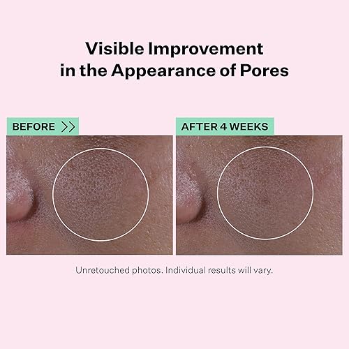 Miniatura 3 de StriVectin Face Oils & Serums to Hydrate Dry Skin, Reduce the Look of Pores and Visibly Clear Complexion, 1 fl oz