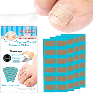 Ingrown Toenail Treatment, Ingrown Toenail Corrector, Toenail Correction Patch Upgrade Material 36Pcs Ingrown Toenail Corrector Sticker Self-adhesive Toenail Patch with 2Pcs Nail Lifting File Tool