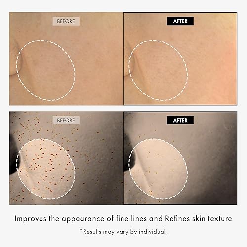 Miniatura 2 de TOSOWOONG Péptido de Cobre 12 Crema, 99% de pureza de cobre tripéptido-1, GHK-Cu, fórmula poderosa de 12 péptidos multi para antienvejecimiento