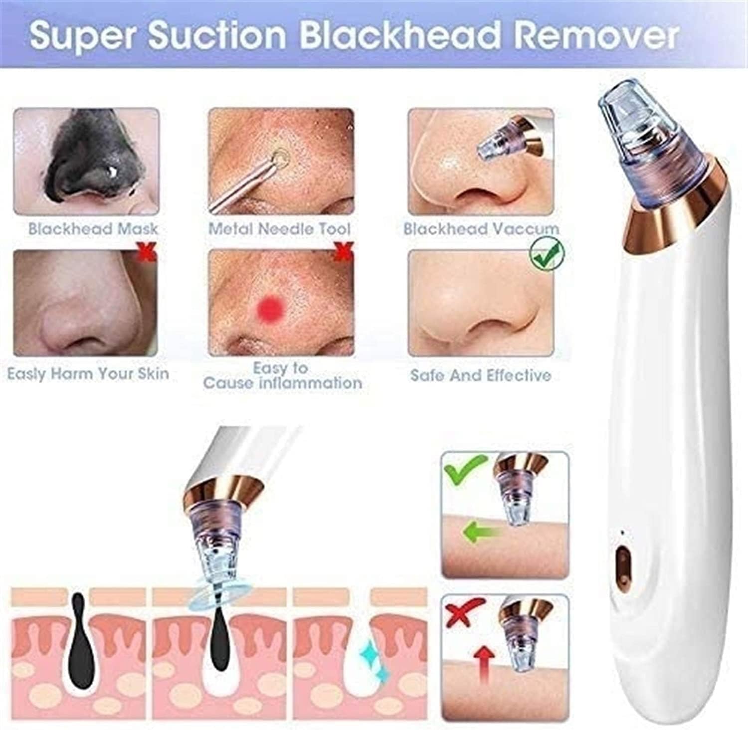 Blackhead Removal Tool, Pore Cleaner Electric Acne Extractor Kit, USB Rechargeable with 5 Replaceable Suction Probes，Safe, Effective, Painless, Portable and Easy to use