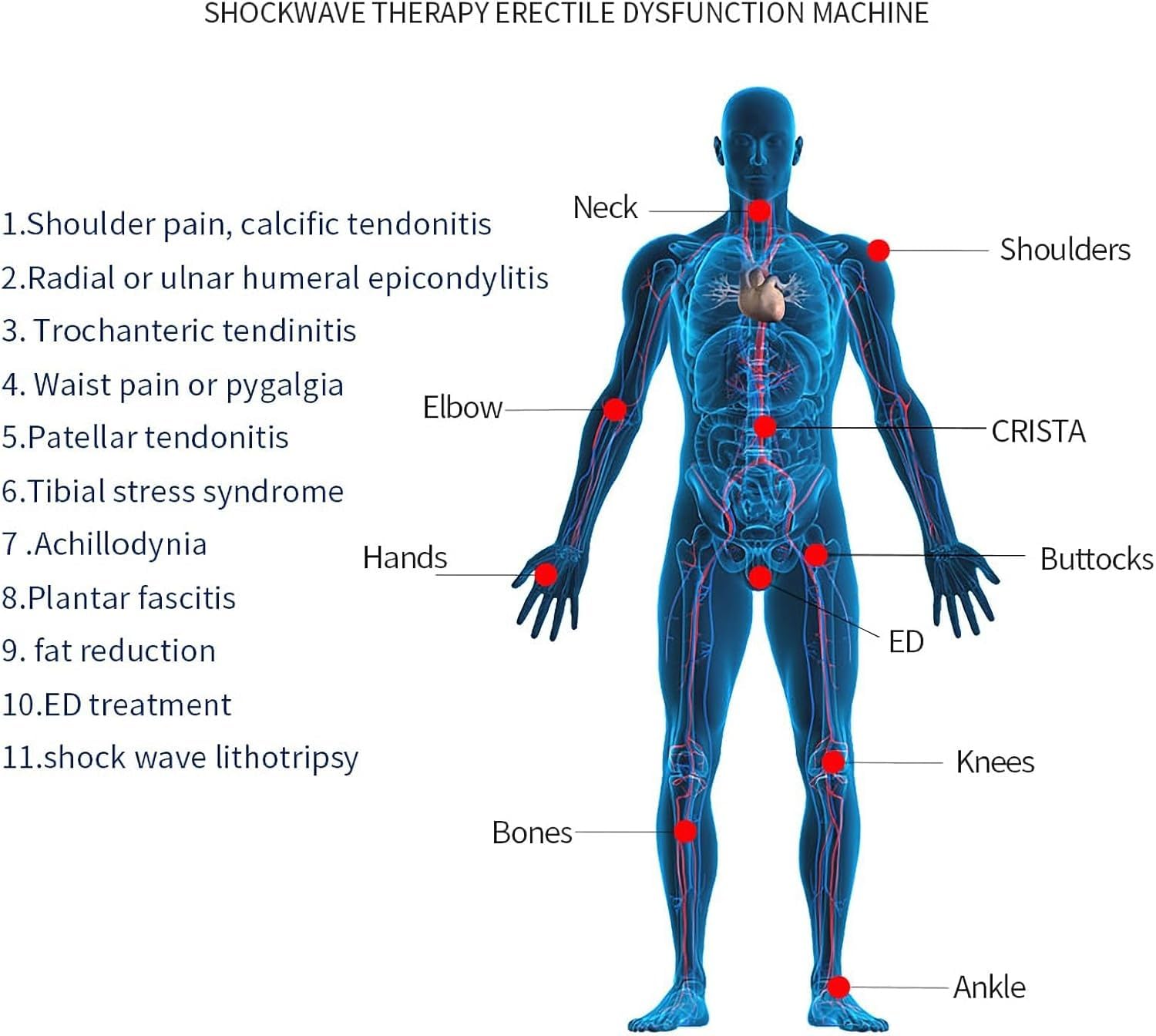 Stoßwellentherapie Gerät, Ballistisch Pneumatisch | Extrakorporal, ED-Therapie, Schmerzlinderungsmassage, Erektile Dysfunktion