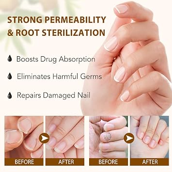 Ginger Nail Treatment 2.02 fl oz, Nail Growth Serum, Ginger Cuticle Care Oil for Nails, Multi-Purpose Nail Repair Nutrient Oil, for Strengthen nails & Promote Nail Growth, Natural Plant Formula