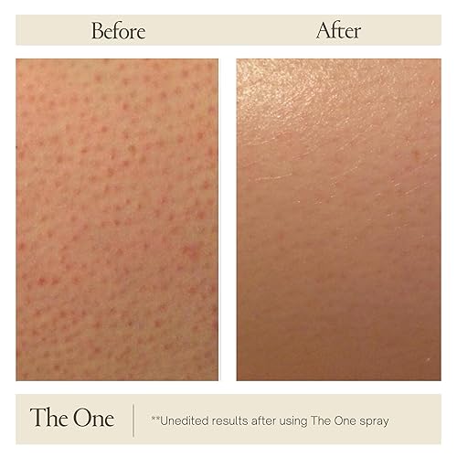 Miniatura 4 de AziMD Skincare The One Spray - Spray corporal de ácido glicólico y ácido salicílico