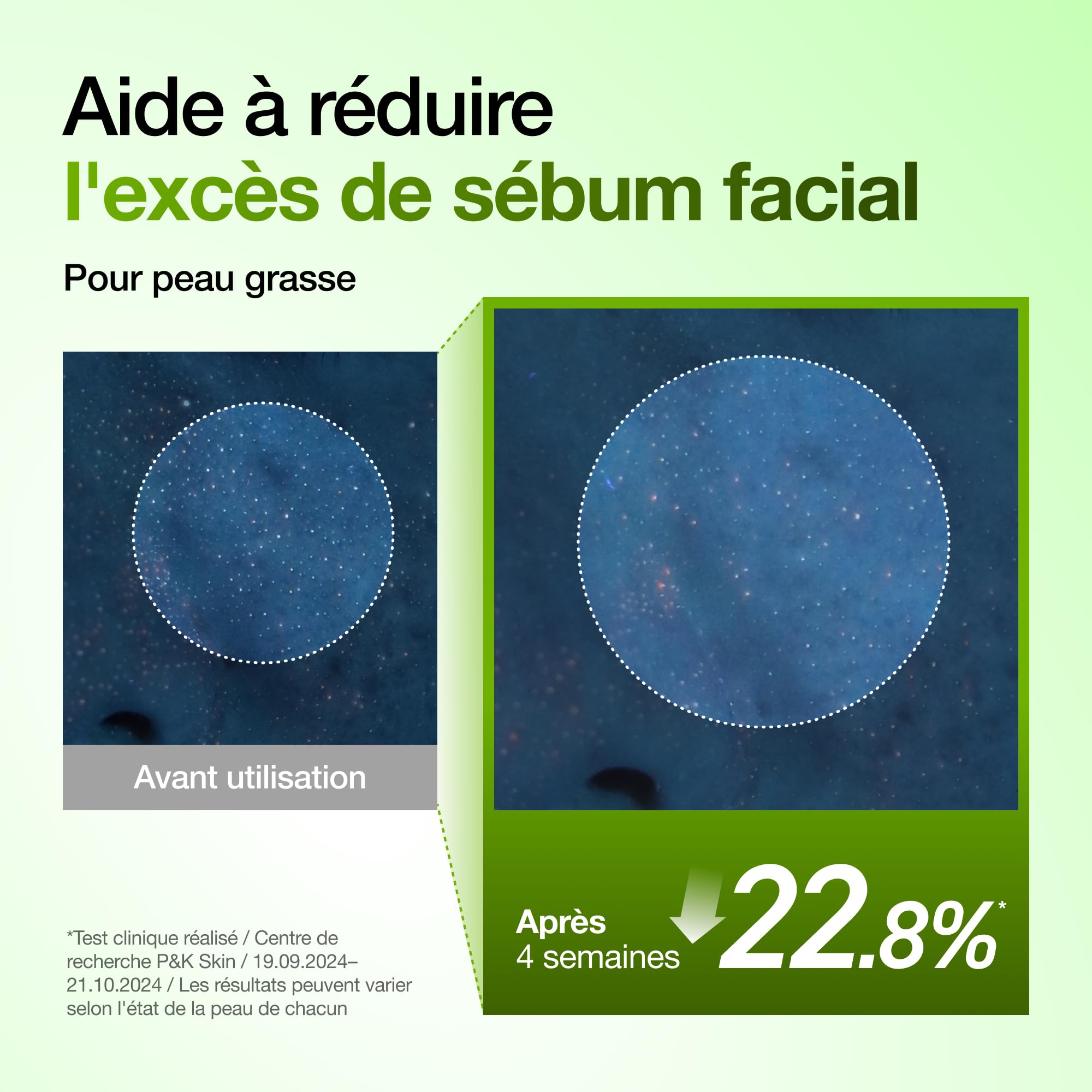 Anua Sérum Acide Azélaïque 10% – Serum Visage Apaisant Rougeurs & Imperfections, Acide Hyaluronique & Niacinamide, Peau Sensible, Skincare Coréenne, (30ml/ 1.01 fl oz.)