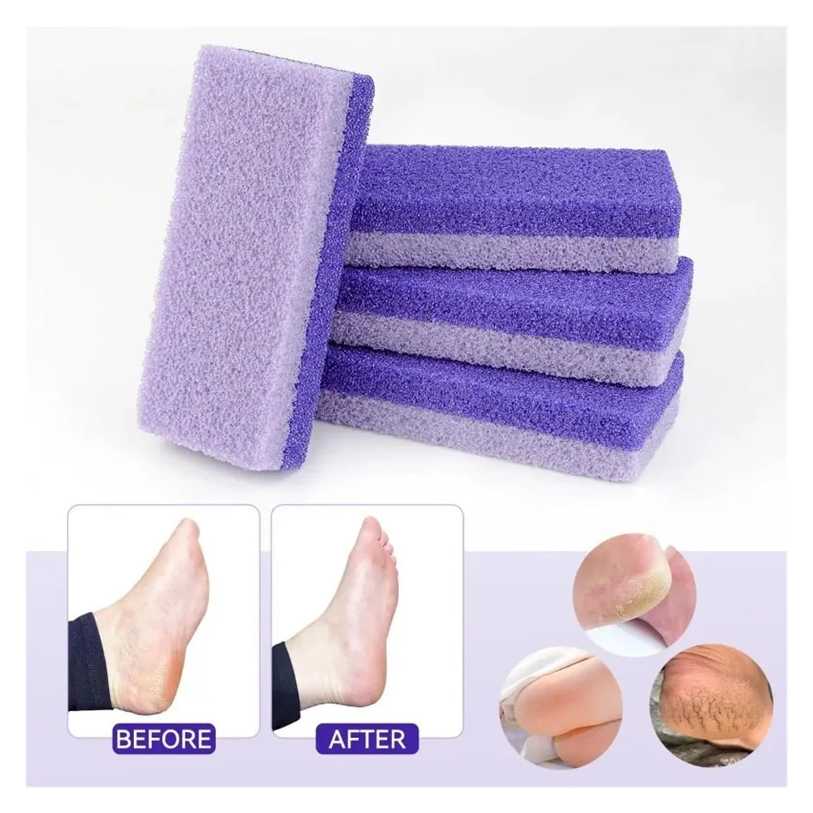 Piedra Pómez for El Cuidado De Los Pies, Depurador Piel Muerta Doble Cara 2 En 1 for Removedor Manos Y Cuerpo(10Pcs)
