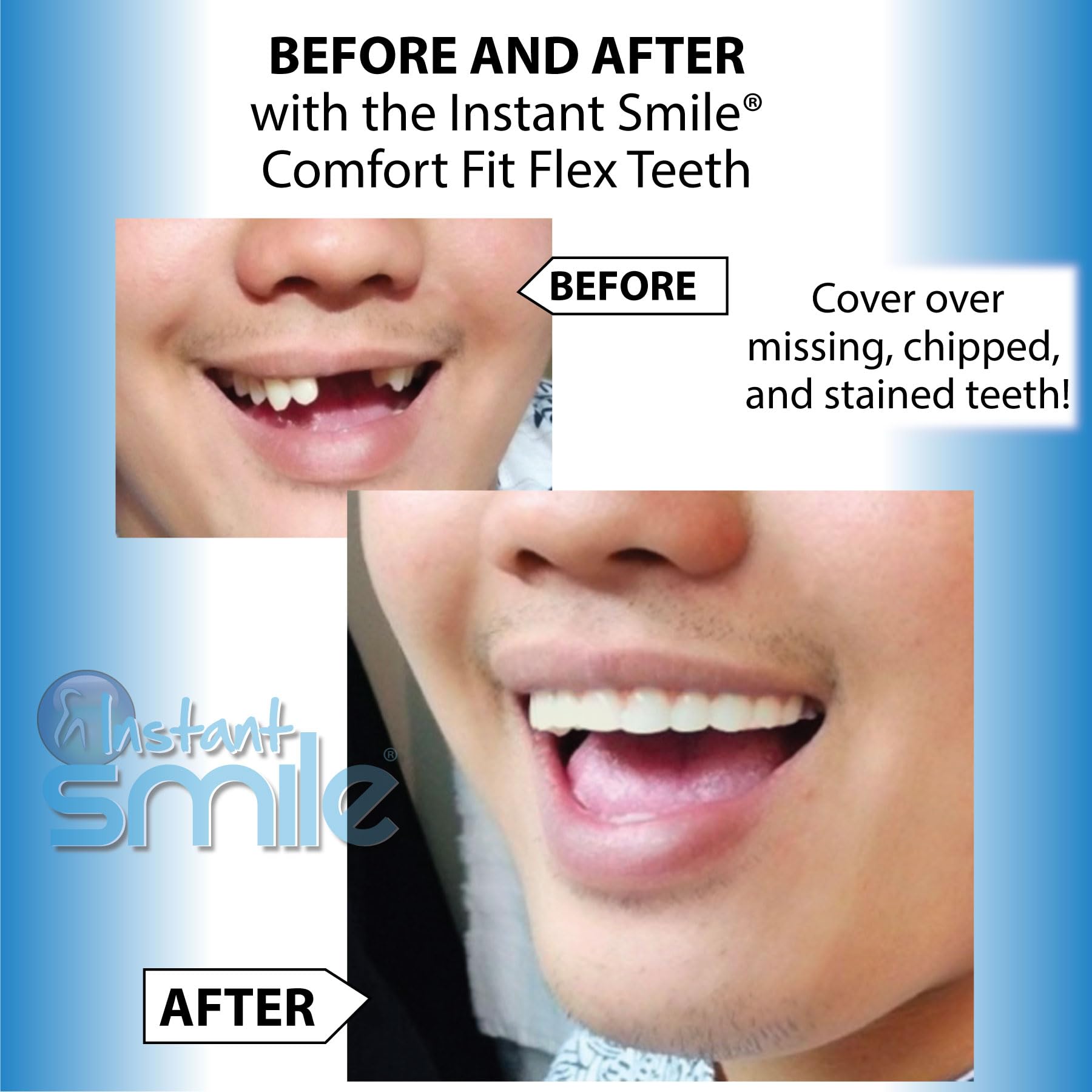 Amazon.com: Instant Smile Comfort Fit Flex Natural Shade