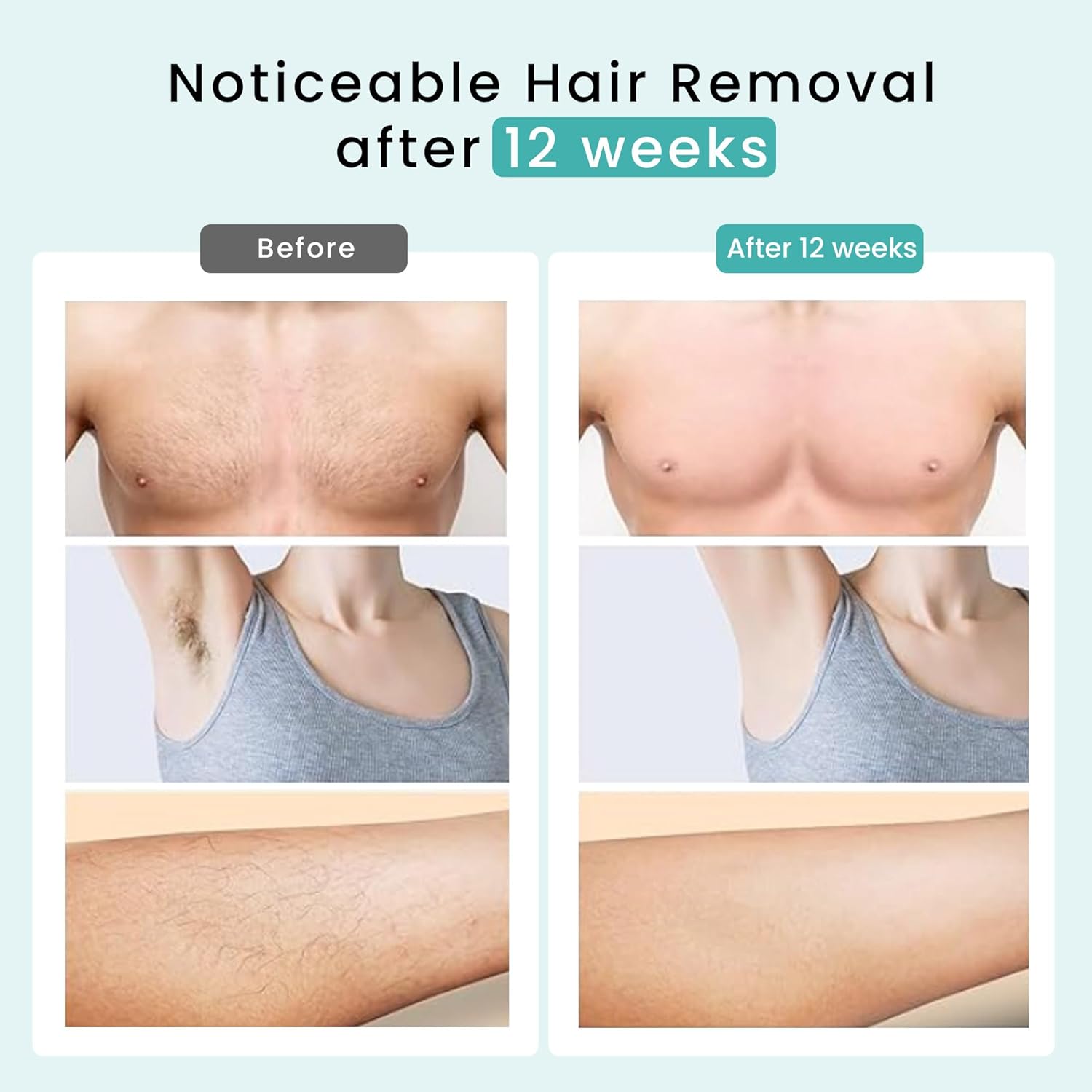 IPL Hair Removal, DermRays Laser Hair Removal, Permanent Reduction in Hair Regrowth for Women and Men, IPL Suitable for Skin Tone 1-5 - Image 5