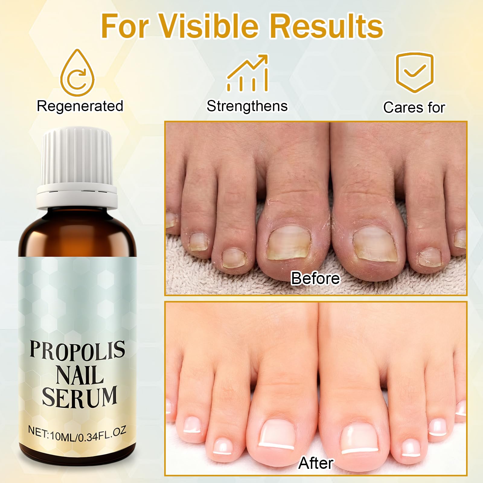 3 Stück Propolis Nagelserum,Bienengift Nagelserum,Behandlungslösung Bienengift,Nagelpflegeprodukte,Geeignet für Brüchige, Trockene und Strapazierte Nägel