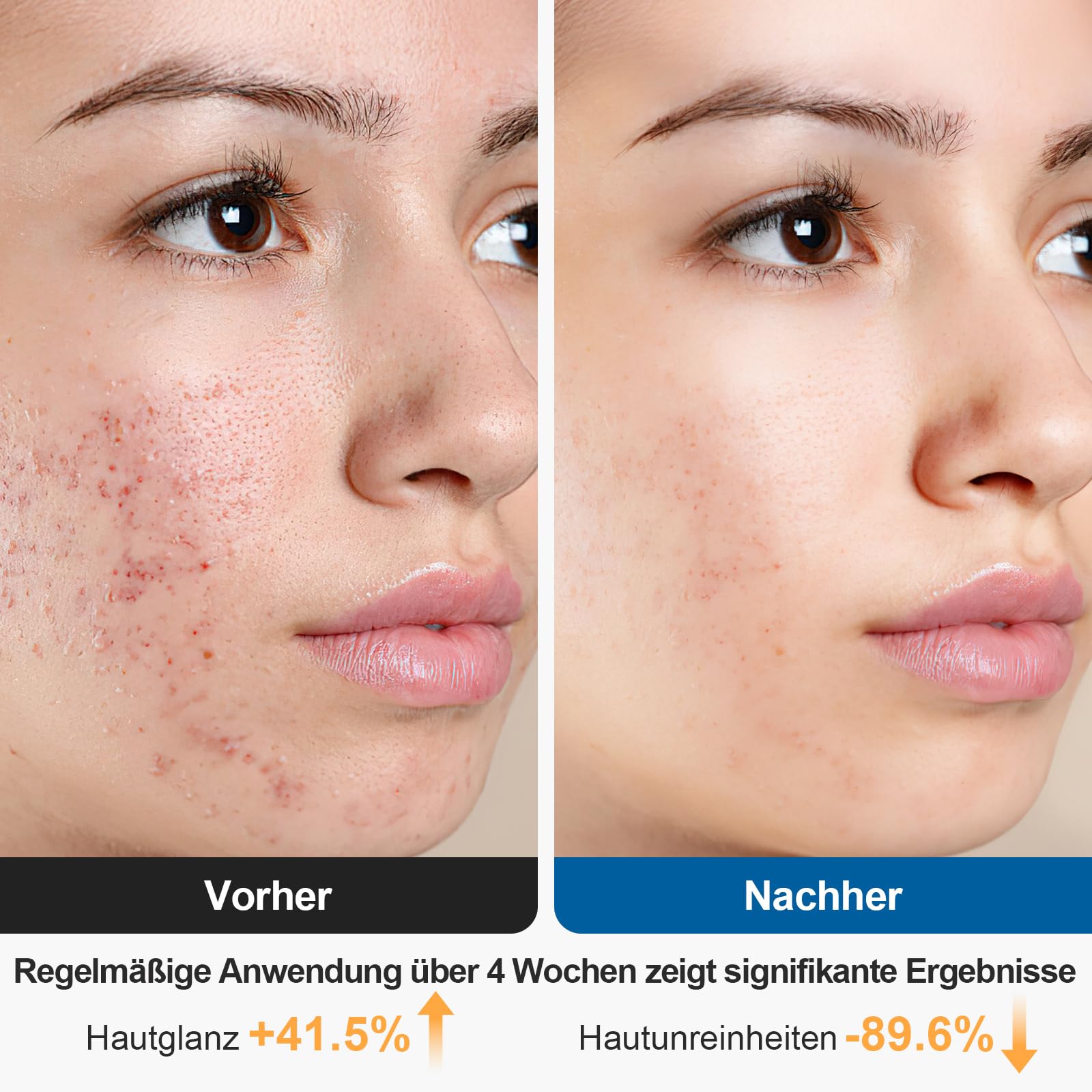 Elektrische Gesichtsreinigungsbürste, 2 in 1 Gesichtsbürste Mit 4 Bürstenköpfen, EMS Gesichtsmassagegerät mit Heizung Wasserdichte Gesichtsreinigung Tiefenreinigung für alle Hauttypen