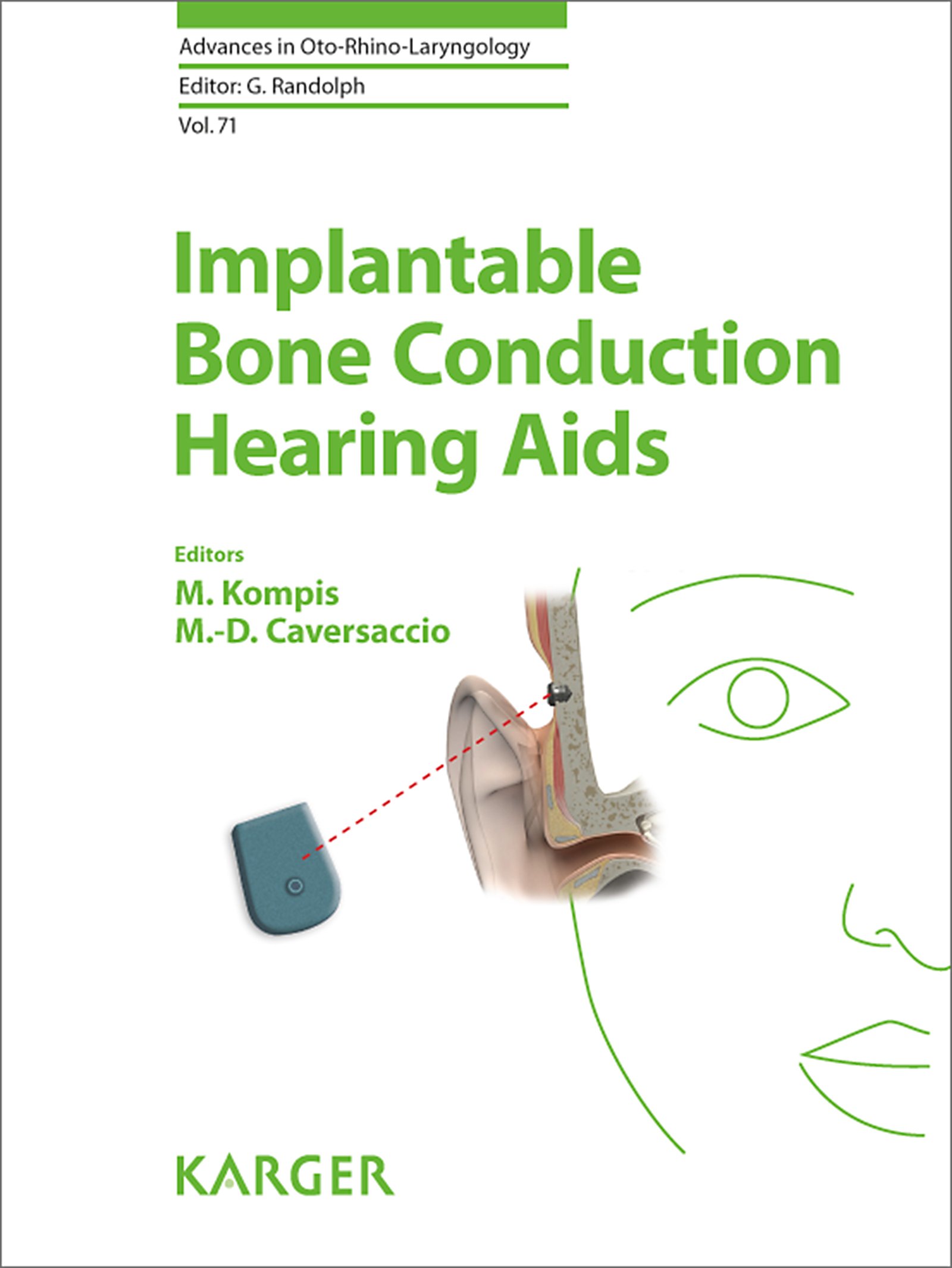 Implantable Bone Conduction Hearing Aids (Advances in Oto-Rhino-Laryngology, 71)