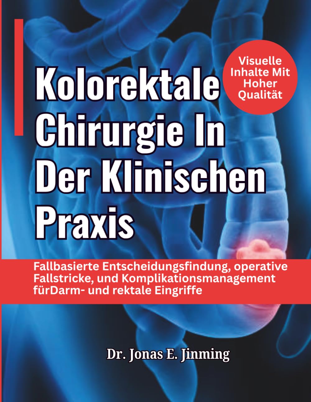 Kolorektale Chirurgie In Der Klinischen Praxis: Fallbasierte Entscheidungsfindung, operative Fallstricke, und Komplikationsmanagement fürDarm- und rektale Eingriffe