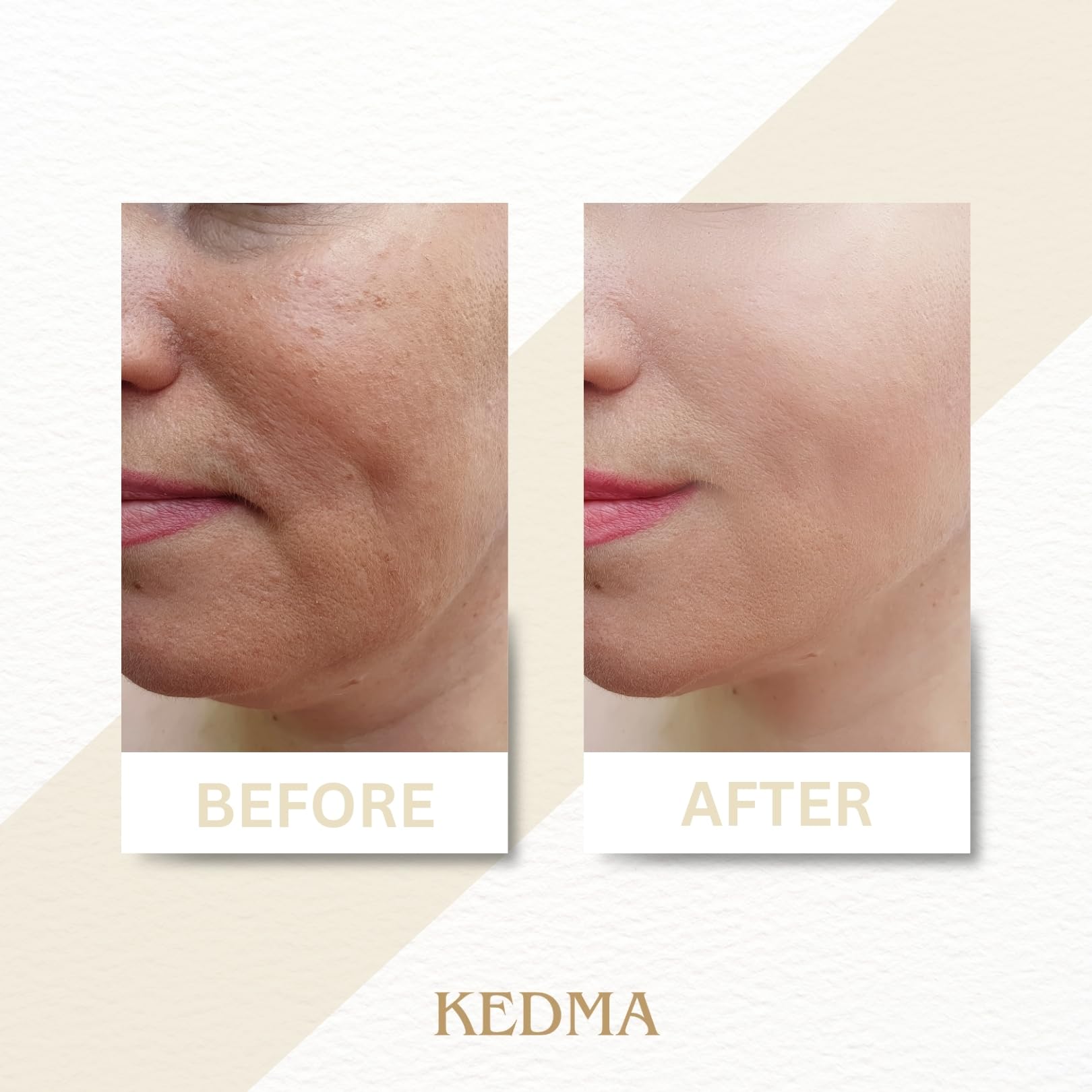 Kedma - Body Butter Gold - Beurre Corporel Nourrissant au Beurre de Karité et Minéraux de la Mer Morte - Pour Peaux Sèches et Rugueuses - 200g