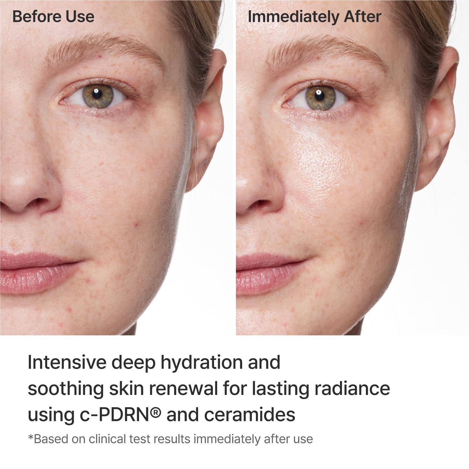 REJURAN Turnover Mask, c-PDRN (5ea) – Firming & Repairing Ultra