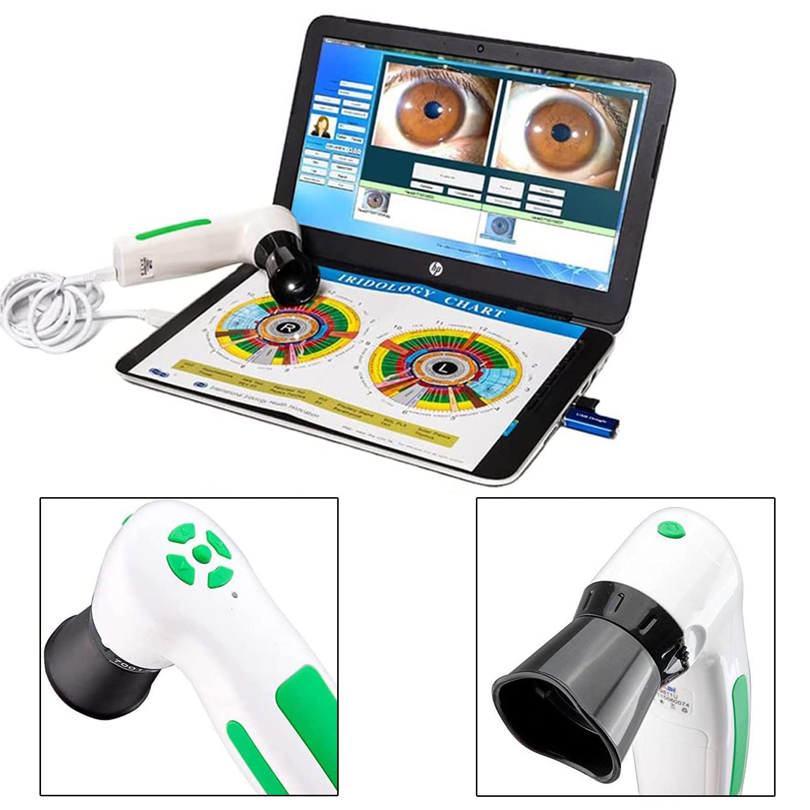Analizzatore dell'iride Iridologia, Fotocamera per iridologia, Alta Risoluzione USB Iriscope Eye Camera, Iriscope con 30x Iris Lens e Software di Analisi