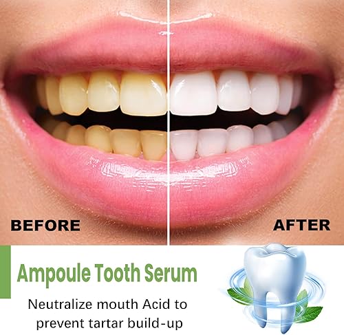 Miniatura 3 de Tlopa Ampolla Pasta de Dientes Suero Diente, Placa de Pasta de Dientes