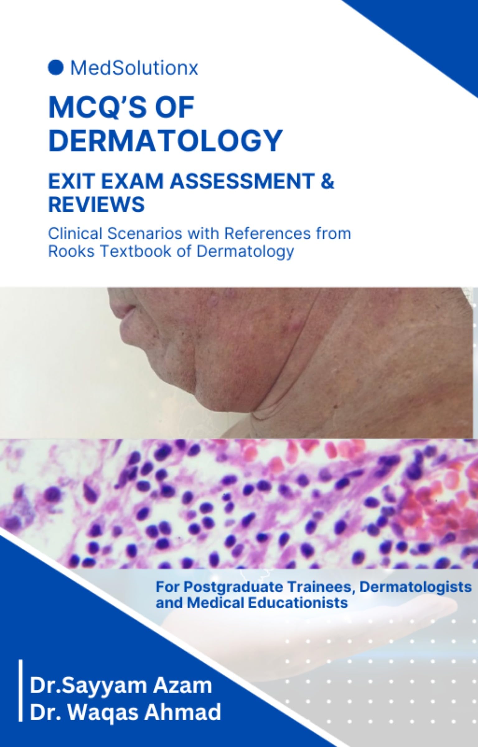 MCQ's Book of Dermatology | Medical Book for SCE DERM, RCSI | Post-Grad Residents: EXAM ASSESSMENT & REVIEWS (English Edition)