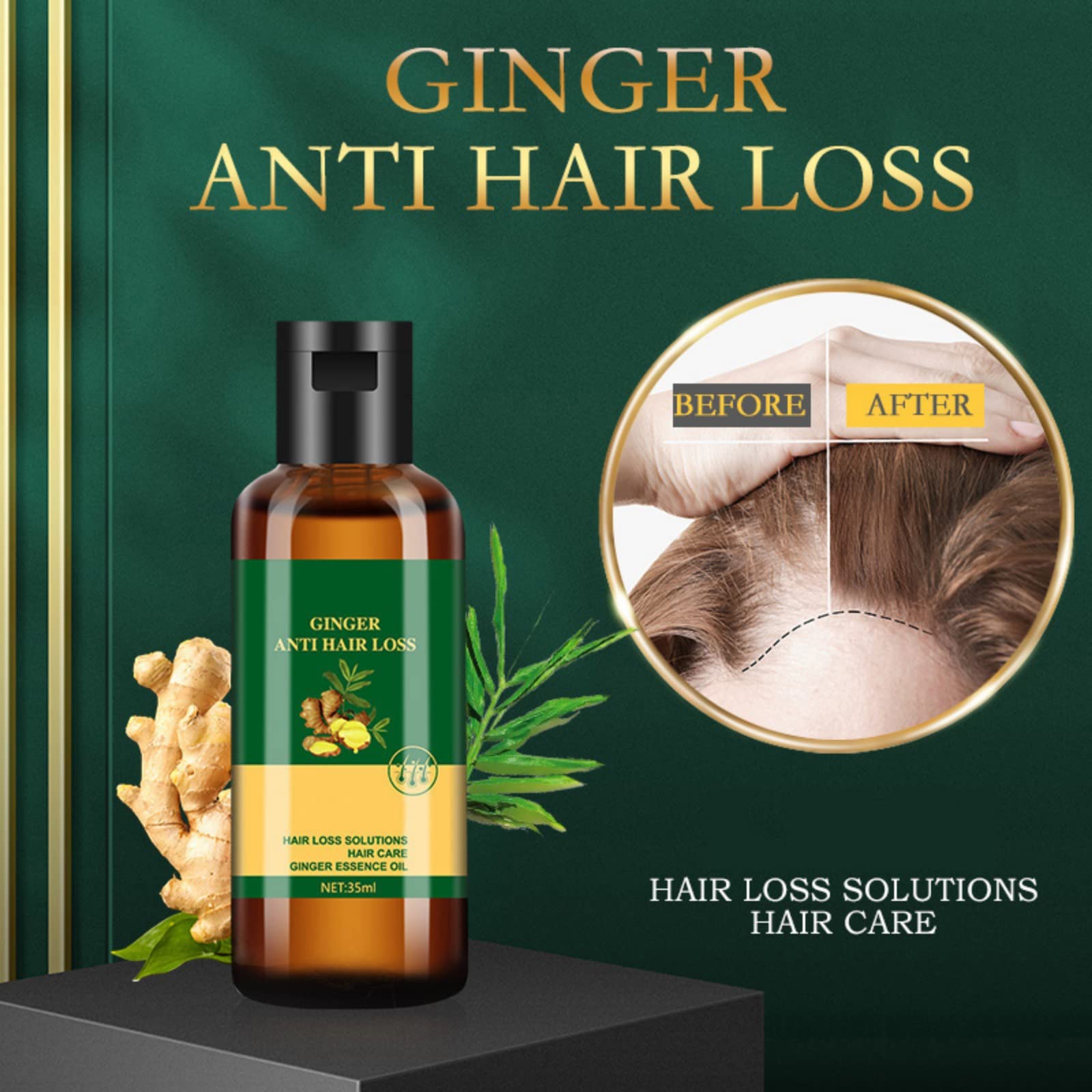 Lidoria Ginger Anti Hair Loss 7 Days, Ginger Essential Oil for Hair Growth Stronger and Fuller Hair, Hair Growth Serum for women for Dry Damaged Hair, Thicker Longer Hair (1.2 Oz(Pack of 3))