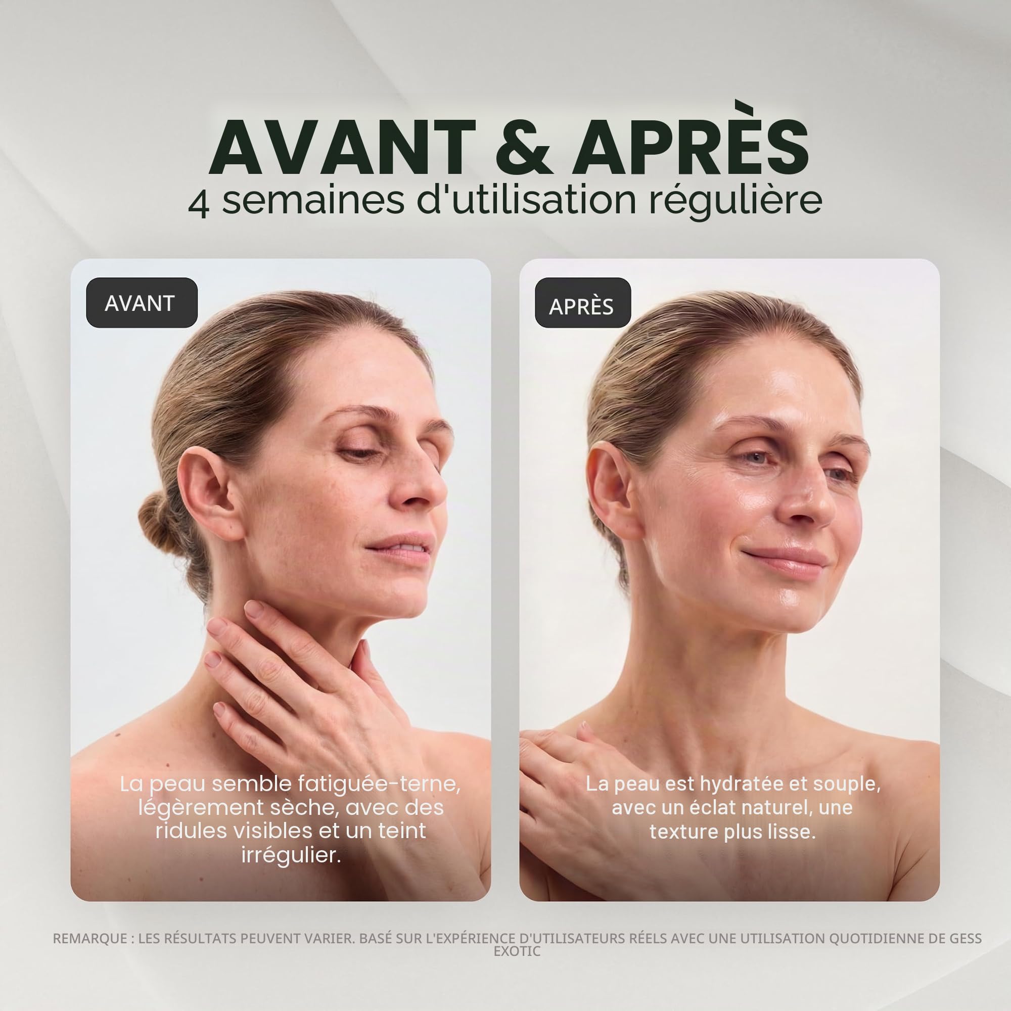 GESS Appareil de lifting facial par ultrasons exotique - peeling doux, raffermissement de la peau, soin anti-âge avec chromothérapie