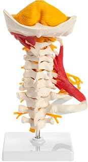 Cervical Spine Model - Medical Model of Cervical Spine With Muscle - For Study or Doctor's Office