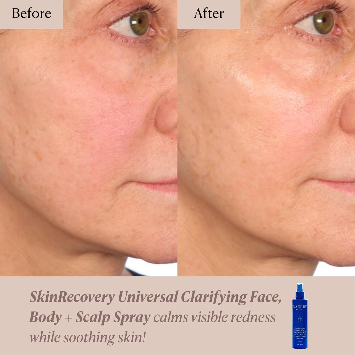 Nakery Beauty SkinRecovery Universal Clarifying Face Body And Scalp Spray With Hypochlorous Acid, Soothing pH Balanced Mist For Sensitive Skin, Helps Reduce The Look Of Redness, Made In USA
