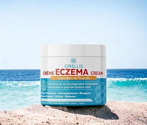 Miniatura 3 de Orellis Crema natural para aliviar el eccema con caléndula orgánica y propóleos, para rostro y cuerpo, adultos y niños. Alivio instantáneo de la
