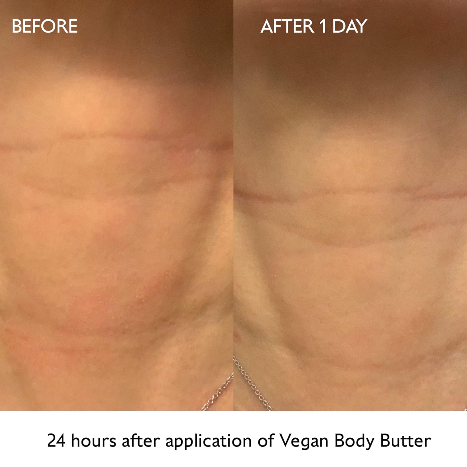 Caudalie Vinotherapist Replenishing Vegan Body Butter with Shea Butter and Grape-seed Oil, Addresses Itching Caused by Eczema and Other Skin Conditions : Beauty & Personal Care