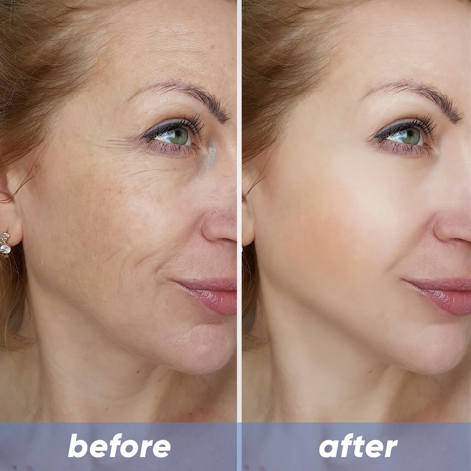 Amazon.com: Noviqo Skin Care, Noviqo Freeze Dried Collagen for