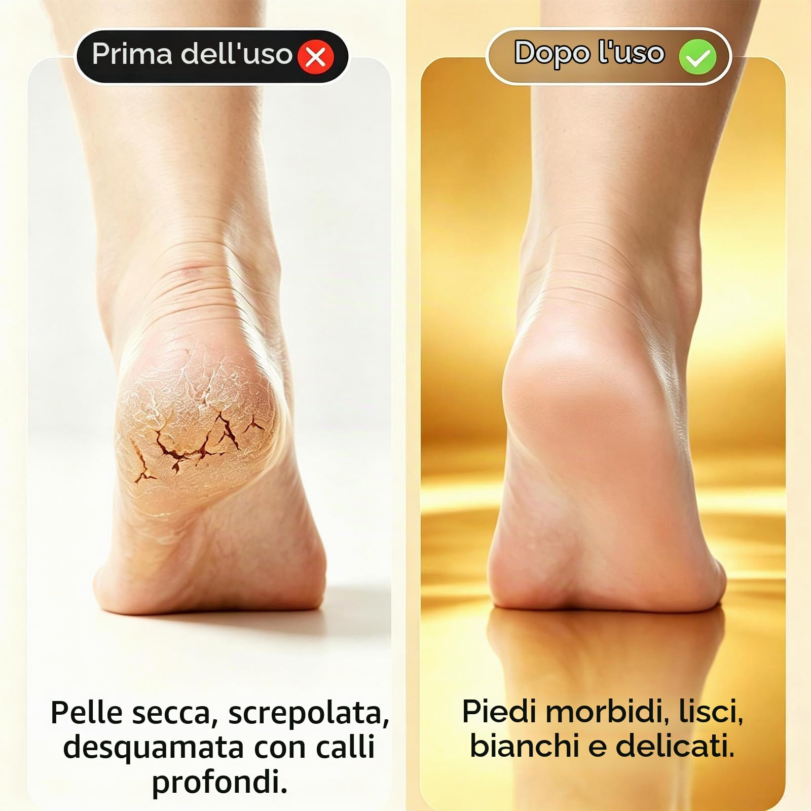 Lima Elettrica per Piedi, Strumento per Calli dei Piedi, Levigatore Elettrico per Talloni, Pedicure Elettrico con 3 Velocità, 2 Testine in Acciaio Inox, IPX6 Impermeabile, Ricaricabile USB