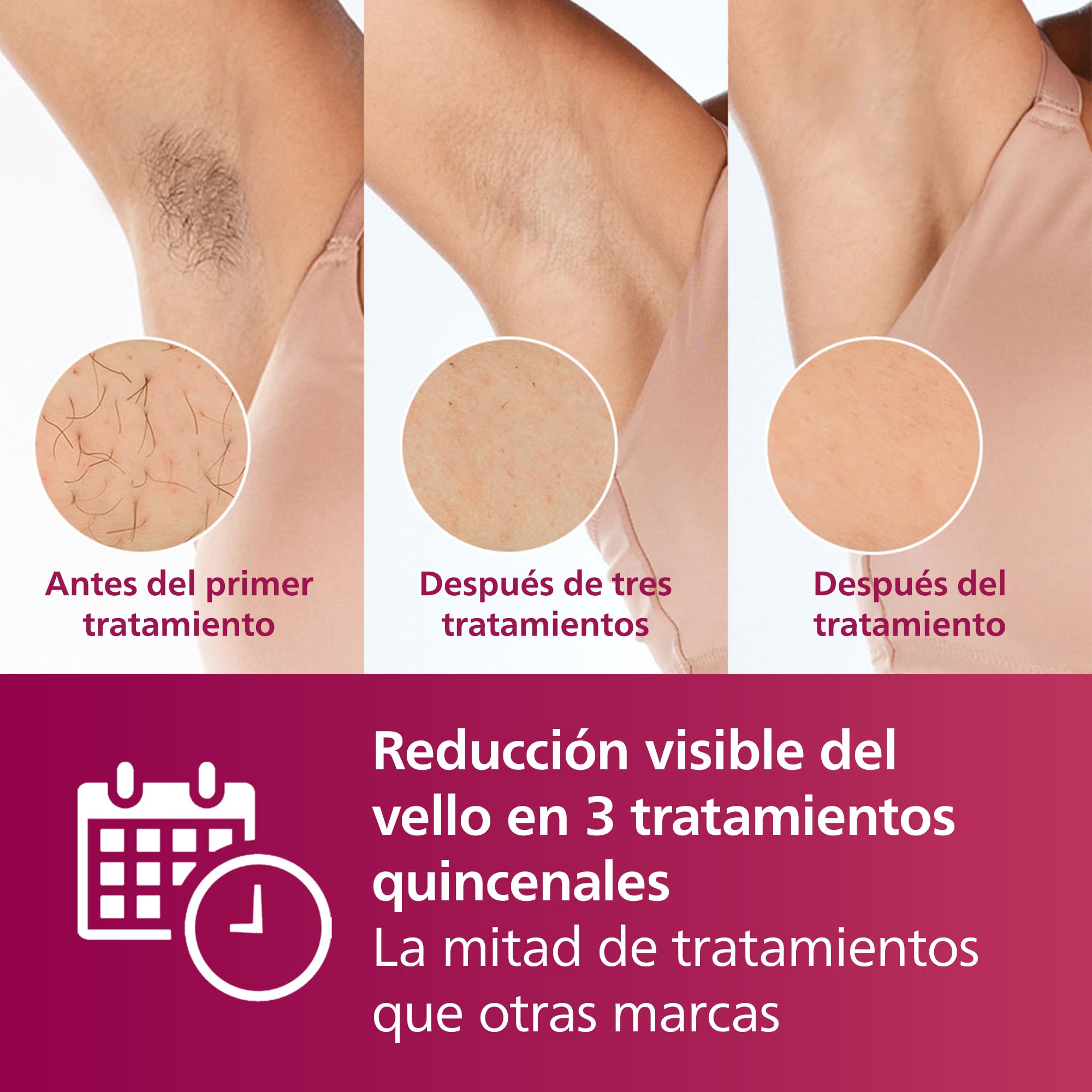 Philips Lumea serie 7000, dispositivo de depilación IPL, alternativa de depilación láser, 3 accesorios para el cuerpo, la cara y la zona del bikini, modelo SC1999/00